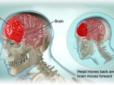 Brain & Spine Trauma