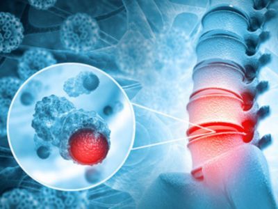 Brain & Spine Infection