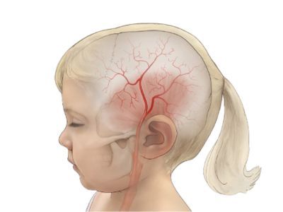 Paediatric Neurosurgery
